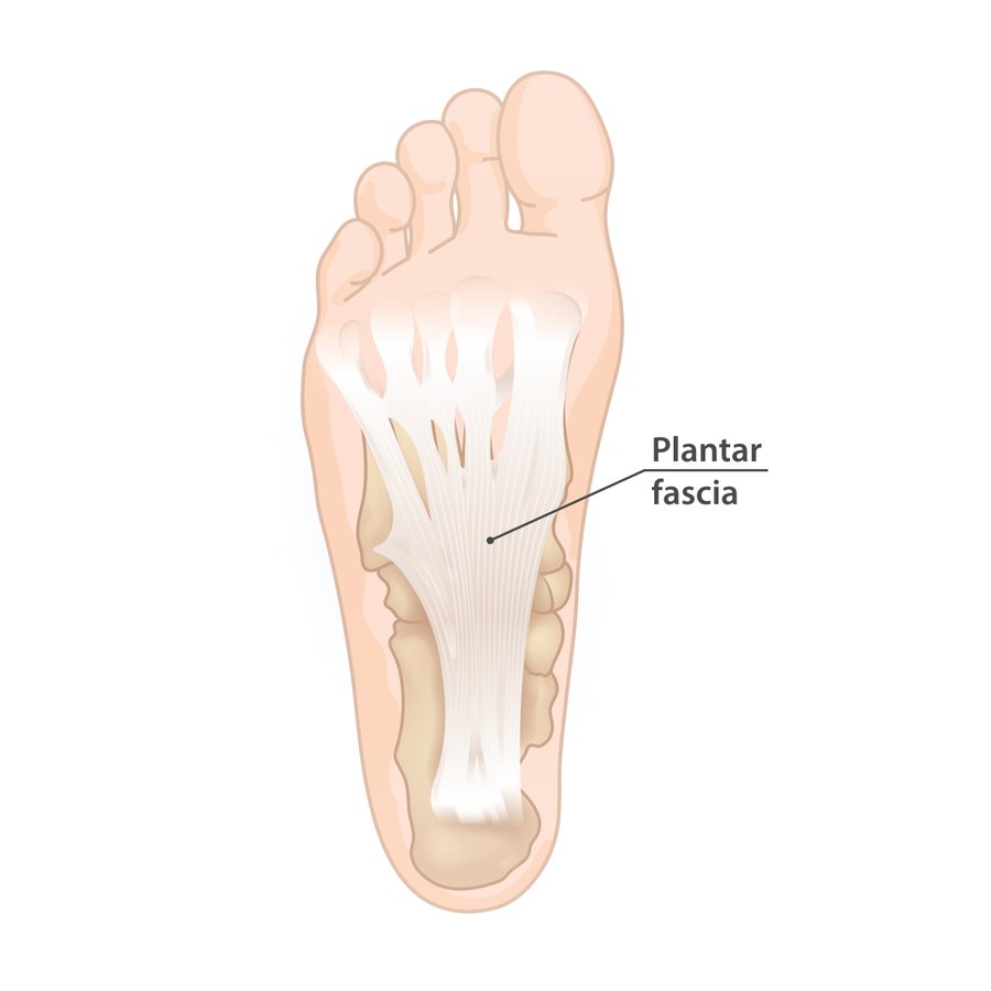 Illustration of the sole of the foot showing the plantar fascia