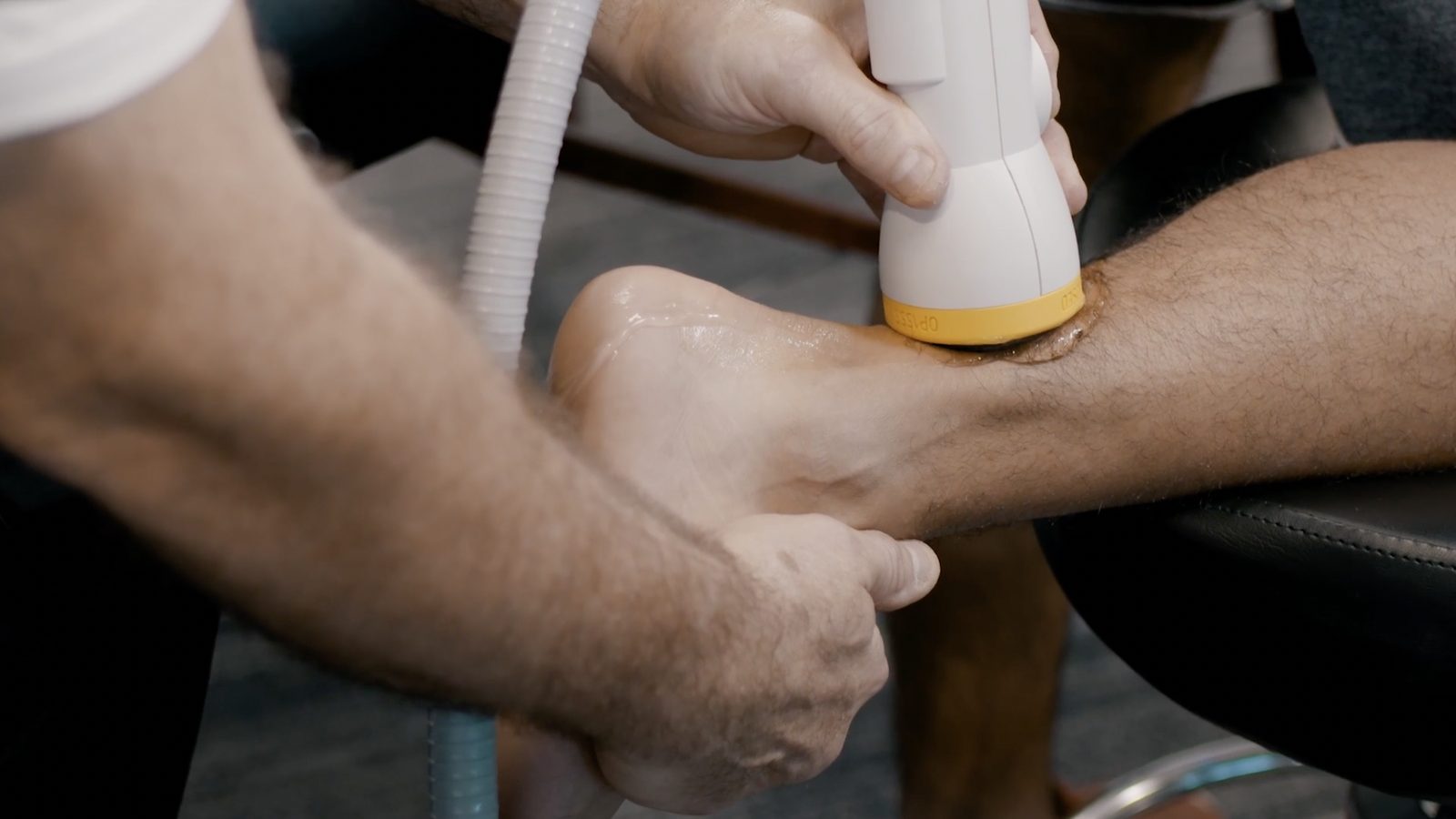 SoftWave shockwave applicator on the back of a patient's ankle, over the Achilles tendon