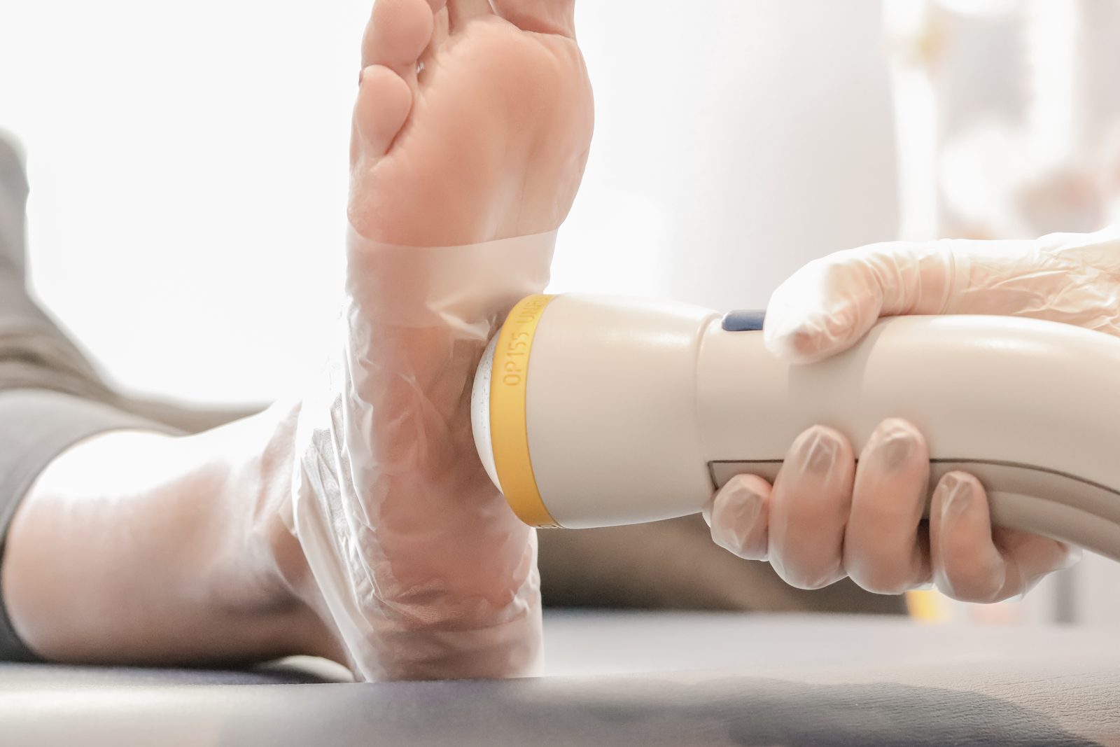 SoftWave shockwave applicator on the bottom of a patient's heel